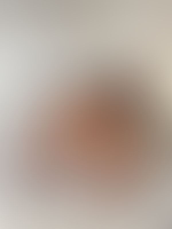 Foto🐇🐰🫦