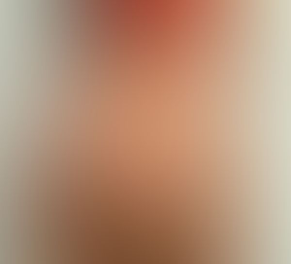 🍎