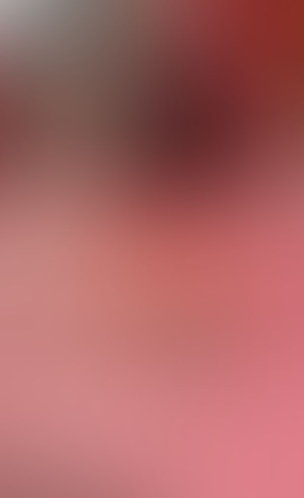 Foto 2🎁