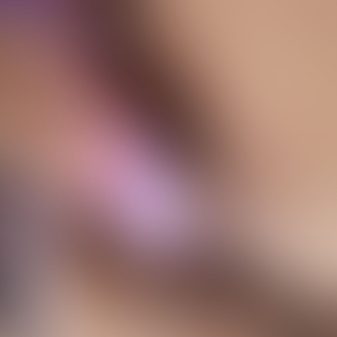 𝟻𝑡𝑎 𝑝𝑎𝑟𝑡𝑒