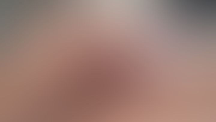 Parte 5