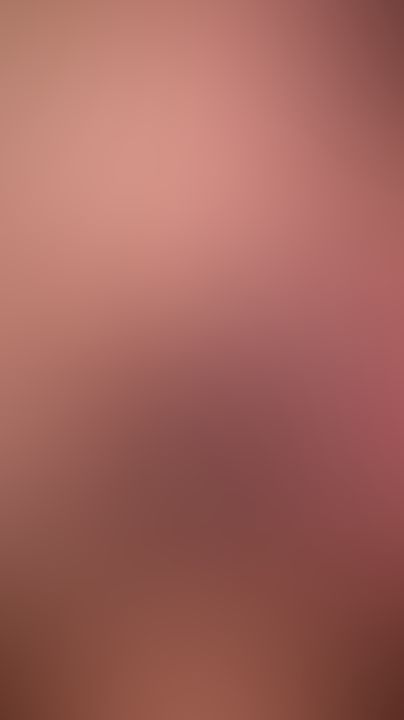 🫩
